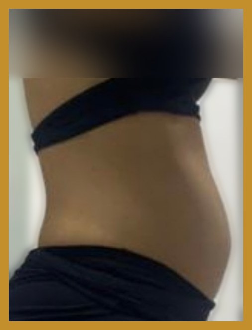Antes — perfil