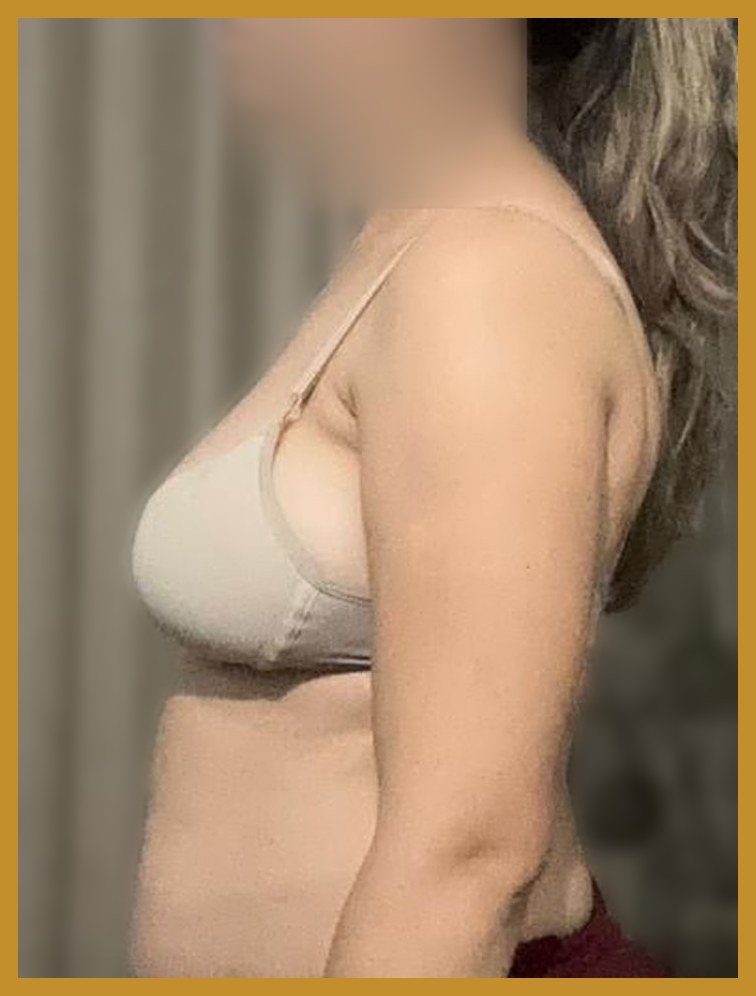 Antes — perfil