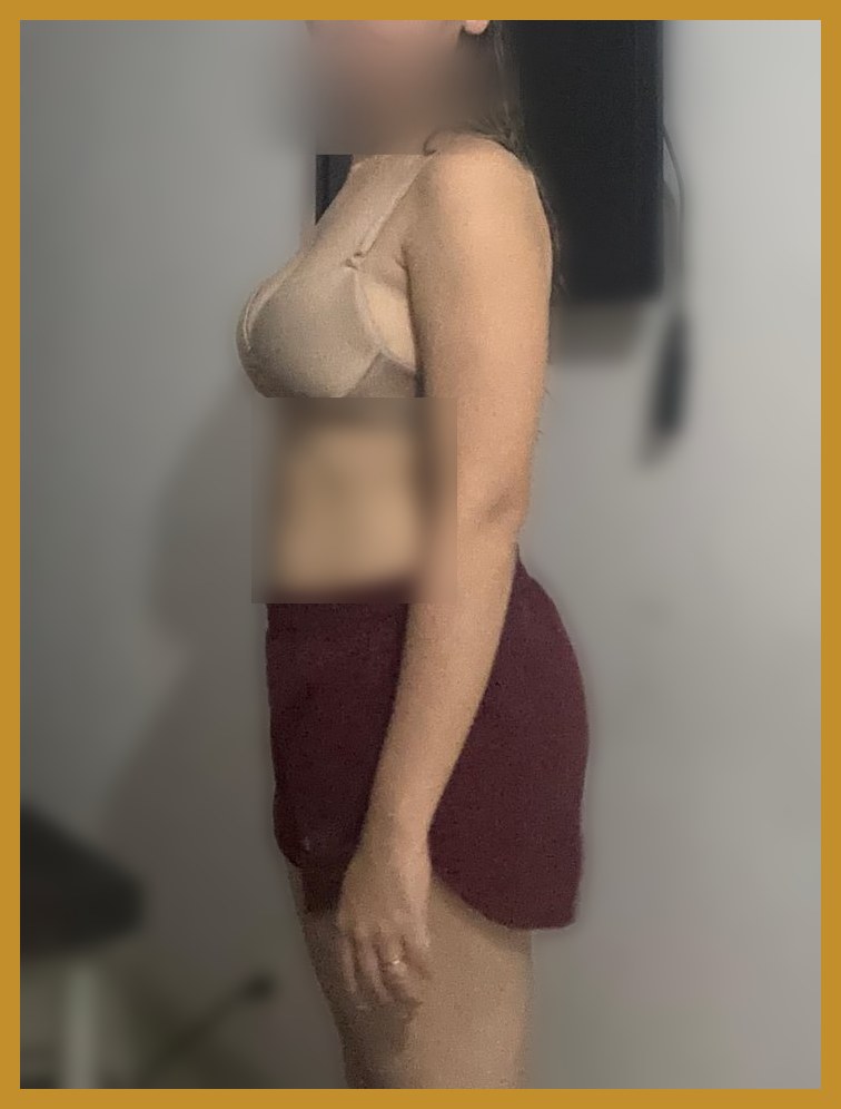 Depois — perfil